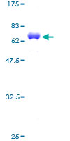 12.5% SDS-PAGE Stained with Coomassie Blue.